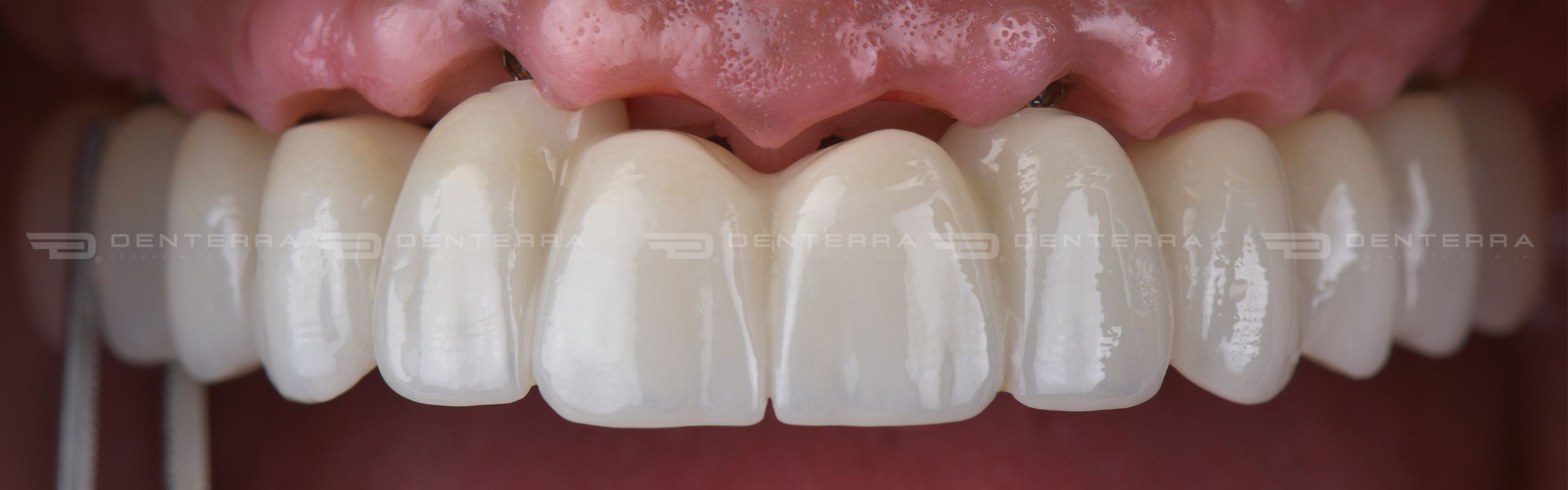 Stomatologie-Premium-Denterra-Brasov